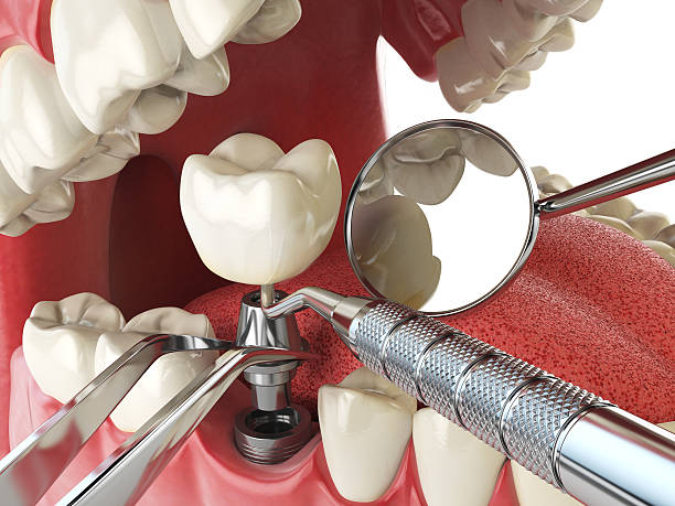 Best Emergency Dental Surgery in Churchville, PA